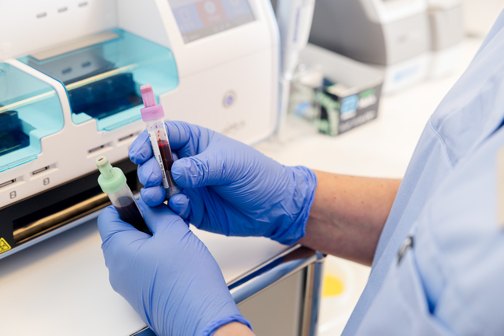 Diagnostik im Labor